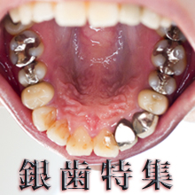特集：銀歯　　